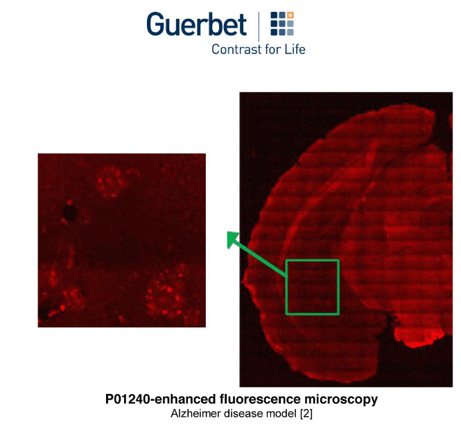 P01240 – Fluorescent USPIO